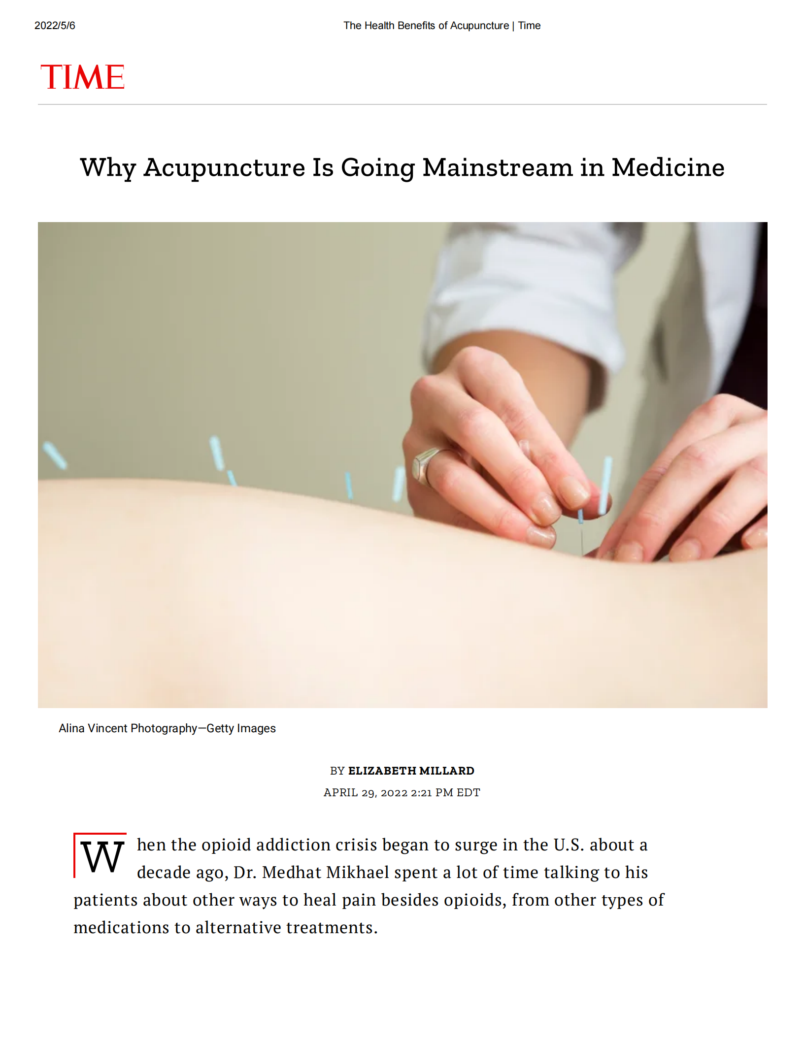 The Health Benefits of Acupuncture _ Time_00.png